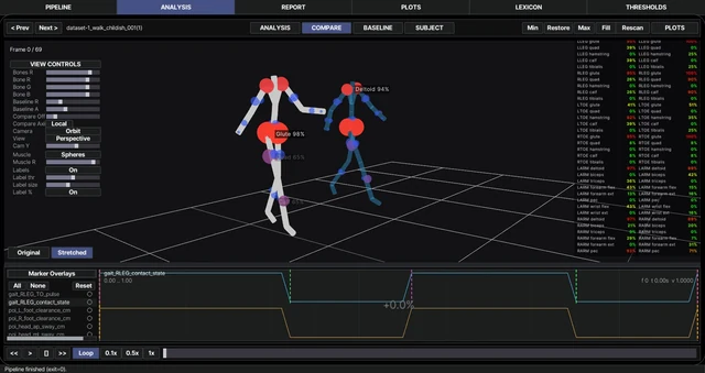 Kineologist GAIT software review interface